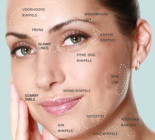 extra toepassingsgebieden botox mia clinic