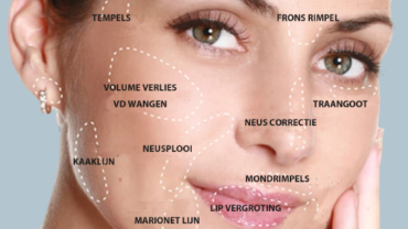 Fillers